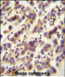 OR1J4 Antibody (C-term)